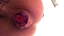22-летняя пролапс бутона розы Cu Arrombado с разбитой дырой, анальная свинья, экстремальный хардкорный фетиш