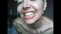 Chantal's teeth fall apart, rotten and black