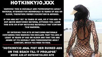 Hotkinkyjo anal fist her ruined ass on the beach till it prolapse