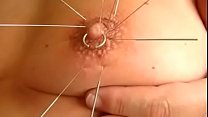 self tit acupuncture