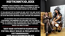 Cameriera sexy Hotkinkyjo fisting anale al gomito, rigonfiamento della pancia e prolasso con Dirtygardengirl