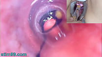ボールと膀胱の成熟した女性のピーホール内視鏡カメラ